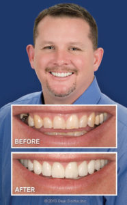 smile-makeover-before-and-after